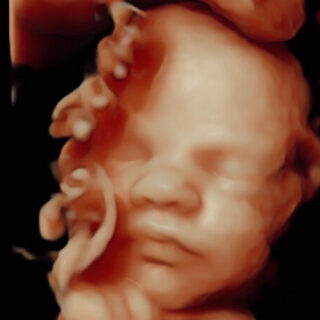 3D 4D pretecho gemaakt bij Goud echo en prenatale screening